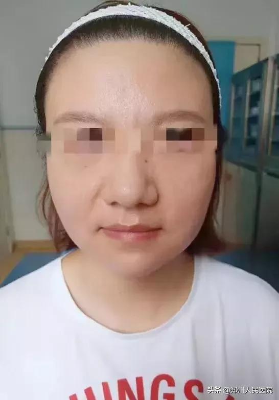 别急！注射玻尿酸之前，先弄清楚这几件事儿