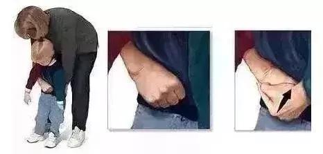 2岁孩子误吞了个小勺子,2岁宝宝误吞枣核第二天没拉出来