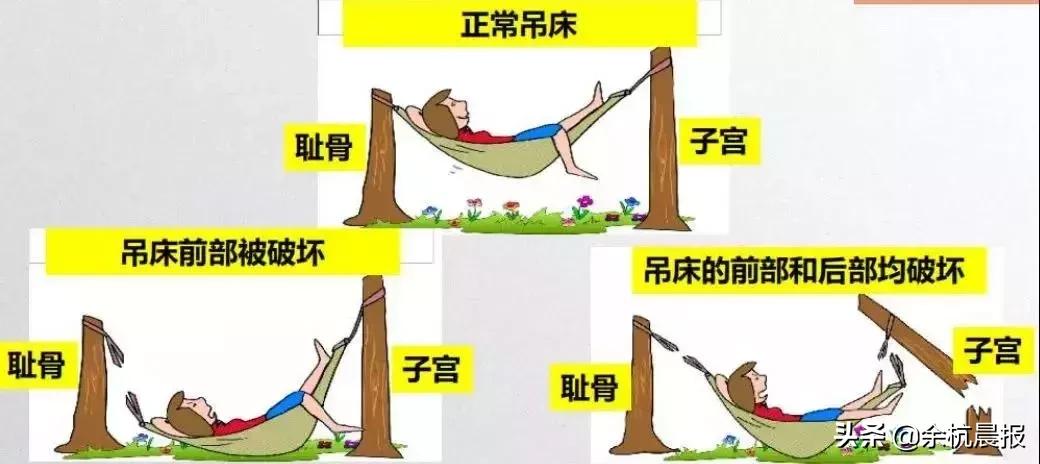 注意！近50%的余杭女性都被这个毛病折磨！这次带来一个好消息！