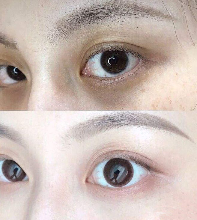 黑眼圈真正有用的眼霜,对付黑眼圈最好用的眼霜