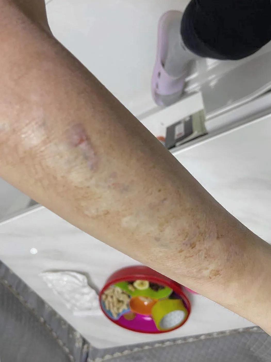 洗文身到底能不能洗干净？