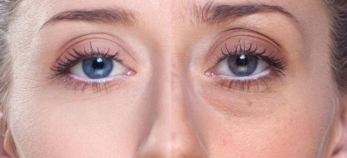 眼霜推荐去黑眼圈细纹抗皱第一名,好用眼霜推荐淡化眼袋测评