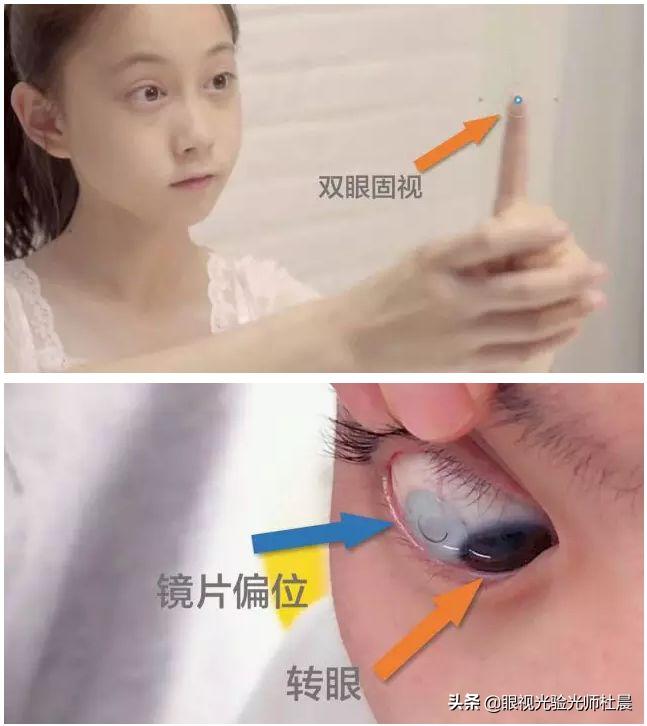 初次戴隐形眼镜有刺痛感,戴隐形眼镜时应注意哪些事项