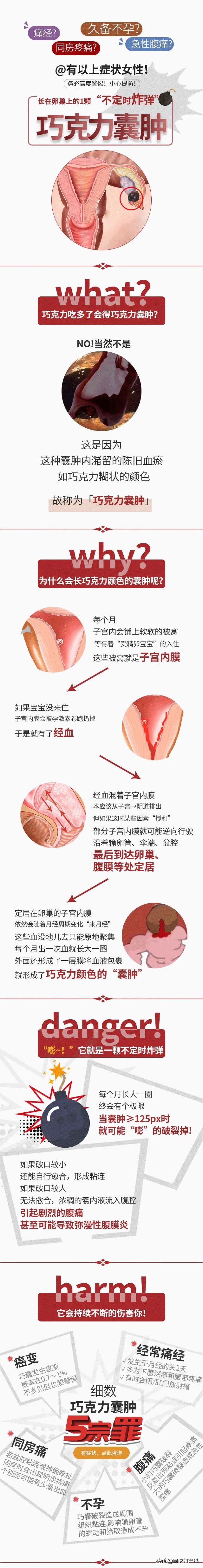 痛经频繁?久备不孕?同房疼痛?警惕卵巢上的“隐形*弹炸**”