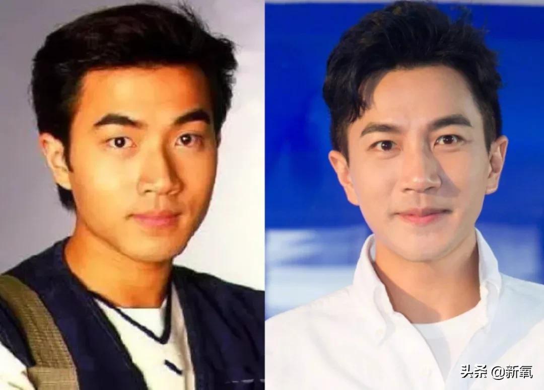 做双眼皮的姐妹还是要慎重,姐妹们你们割双眼皮多少钱