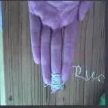 遇到小孩流鼻血怎么解决,遇到小朋友流鼻血会怎样处理