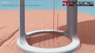 激光美容有哪些必要做,激光整形真相