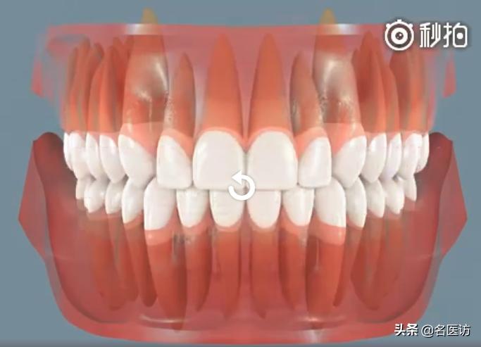 牙齿矫正签合同要注意什么坑,牙齿矫正需要注意什么问题