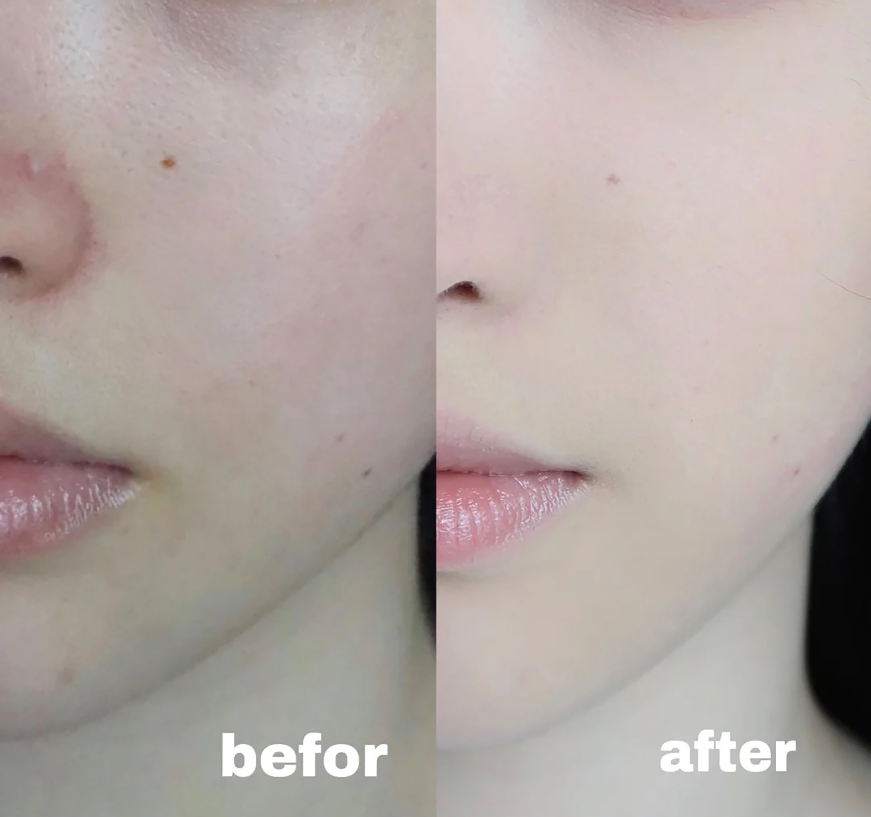 unny和uodo干皮粉底液哪个好,兰蔻po-01粉底液适合干皮还是油皮