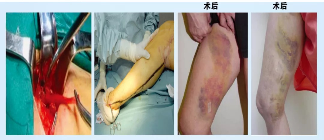 西安红会医院心血管住院部,西安市红会医院心血管内科地址