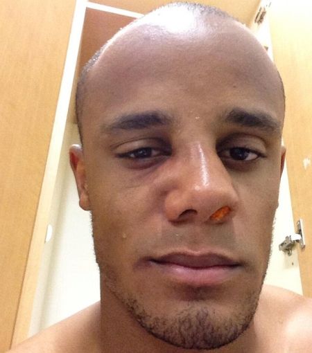 印堂有一条线凸起面相,女性印堂有点低线的面相