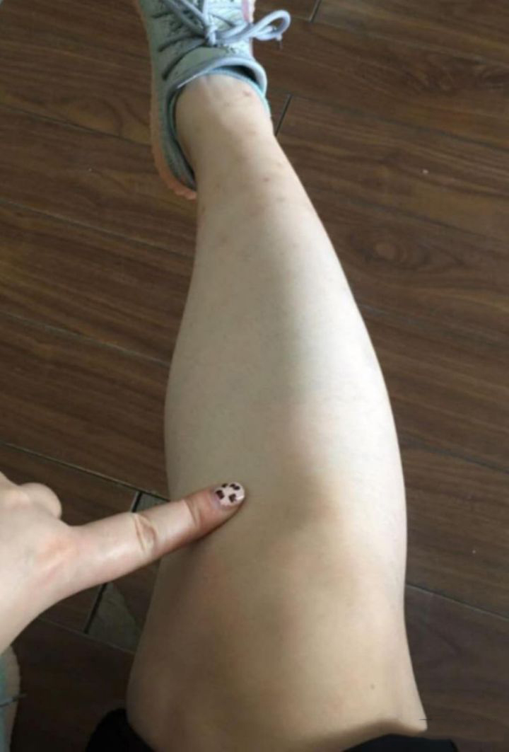 微胖女生怎么减肥成效好？妹子从128斤减到96斤，分享瘦腿经验