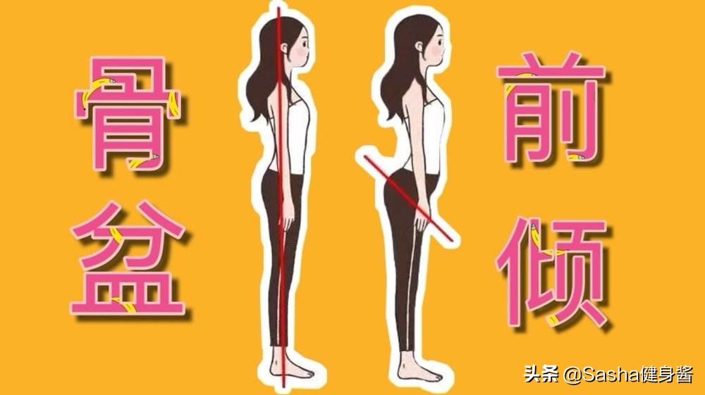 跑步膝怎么治疗,跑步如何避免膝盖超伸