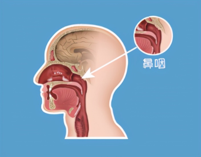 特需门诊@你|鼻咽癌“偏爱”广东人？早防早治是关键