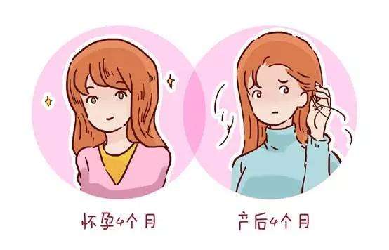 产后脱发严重新妈咪该如何应对,产后妈妈脱发的原因和治疗