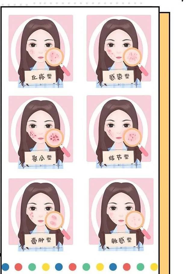 16岁青春痘可以刷酸护肤吗,14岁女生长青春痘怎样护肤