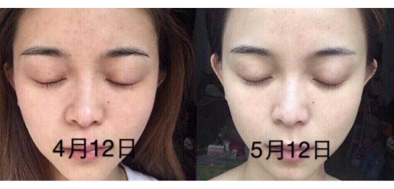 美容黑幕,美容仪内幕大揭秘