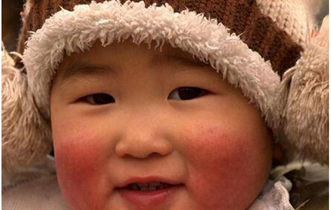 冬季宝宝皮肤究竟应该如何护理呢,冬天宝宝皮肤干用什么护肤品