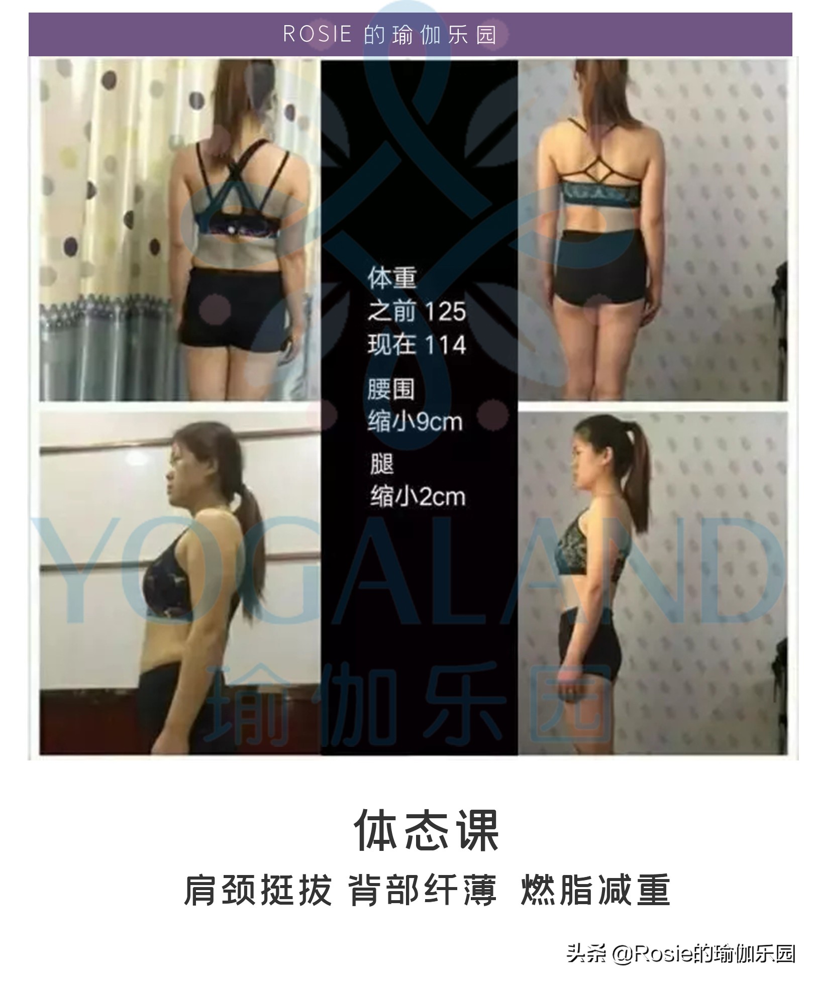 脖子前倾轻微驼背穿搭,脖子前倾体态不好怎么改善