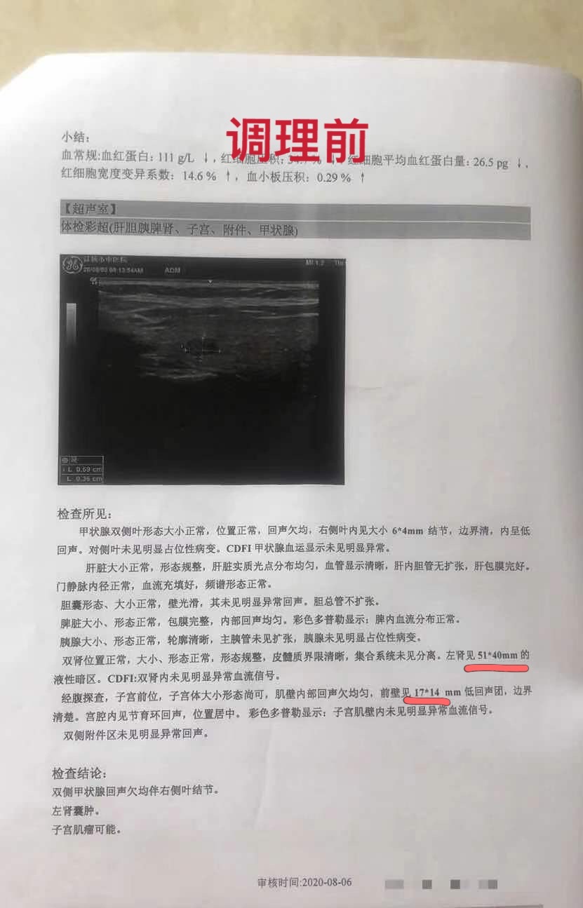 甲状腺结节子宫肌瘤卵巢囊肿调理,甲状腺乳腺结节子宫肌瘤如何调理