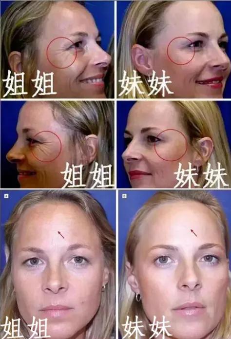 做了整形手术是不是以后老得快,做整形手术最佳年龄