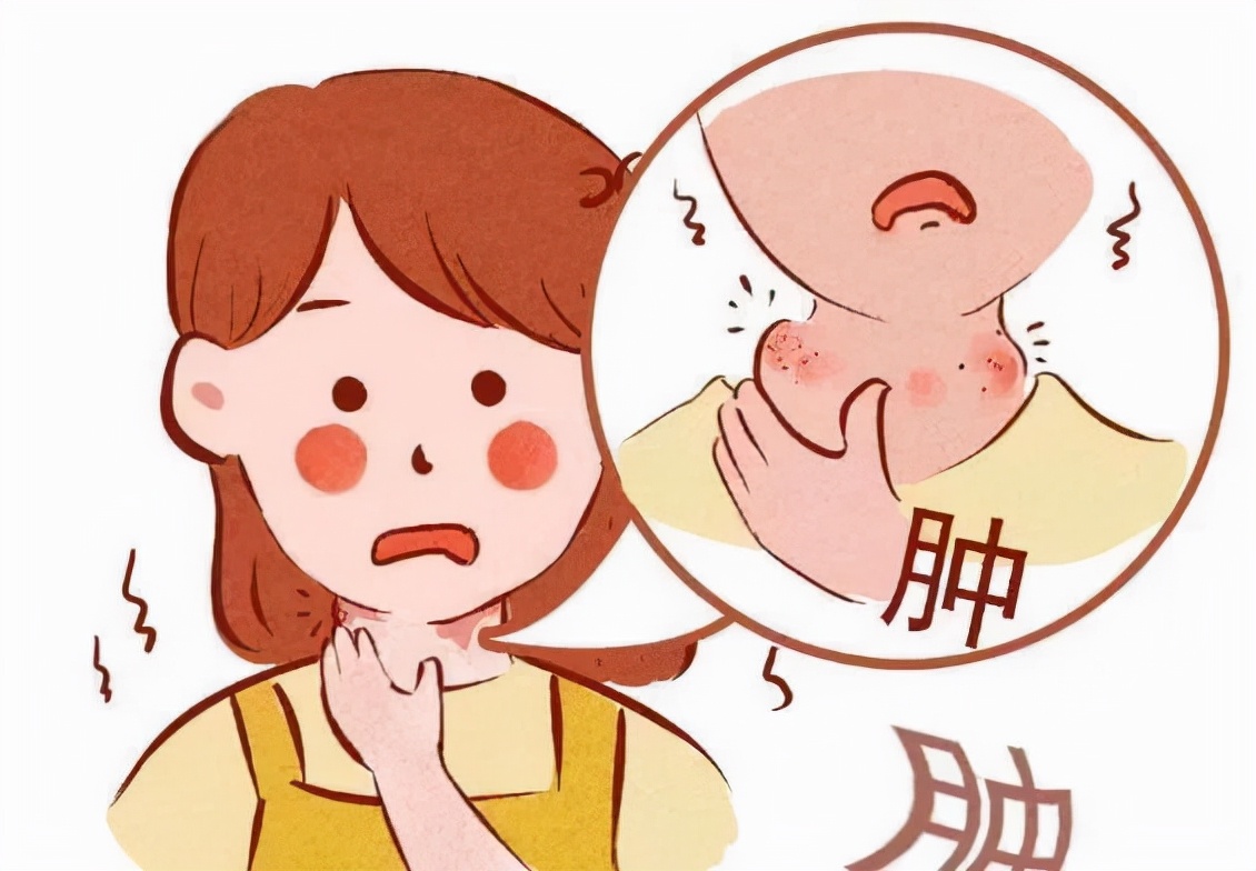 桥本轻微甲亢,桥本甲亢5年还没好