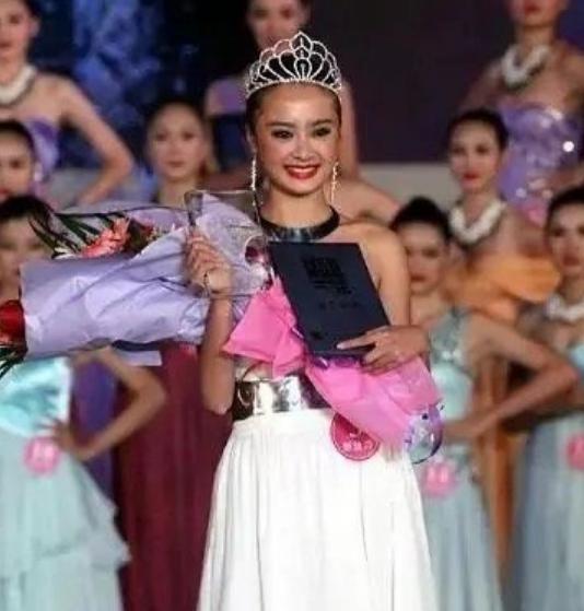 齐明月孙铱整牙,齐明月孙铱私下关系