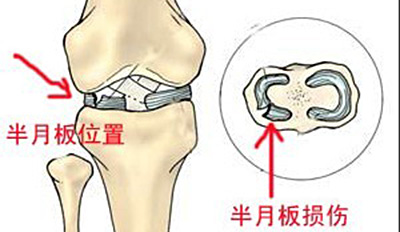 氨基葡萄糖软骨素是药还是保健品,氨基葡萄糖软骨素是激素药吗
