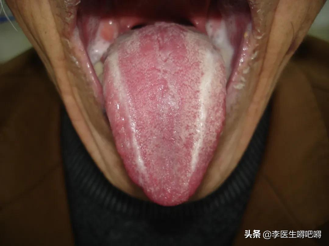 好苦恼！雨一直下，身体有点怕怕！对抗湿气养生5招做起来