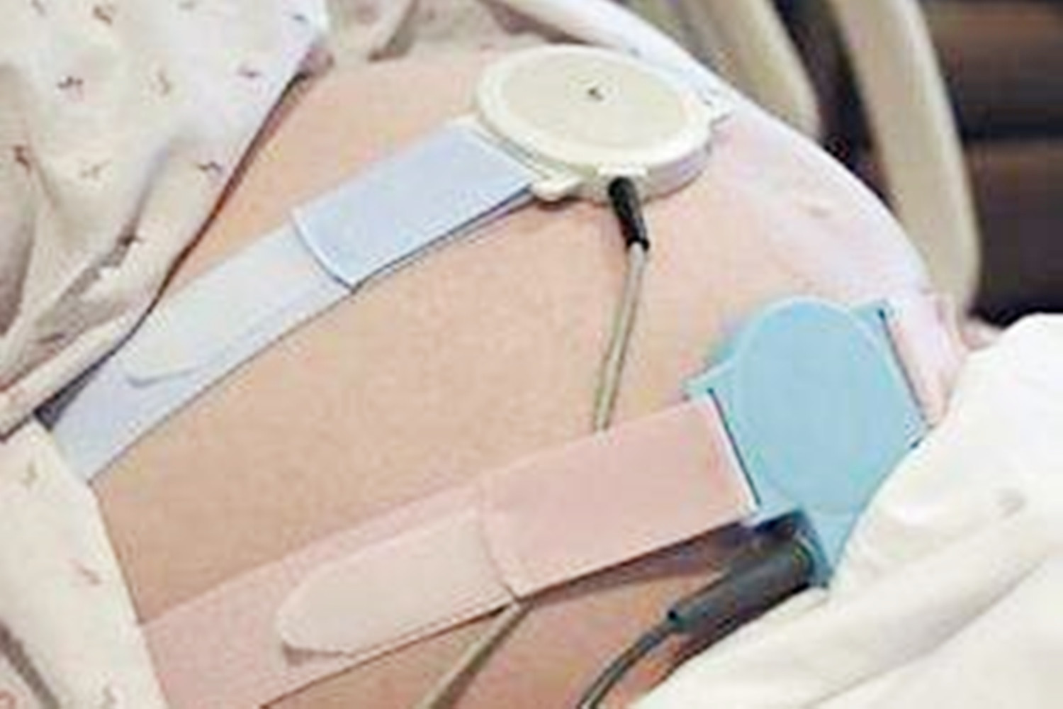 超过预产期多少天算过期妊娠,超过预产期四五天正常不