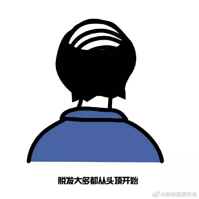 我国超2.5人脱发,中国有多少人脱发