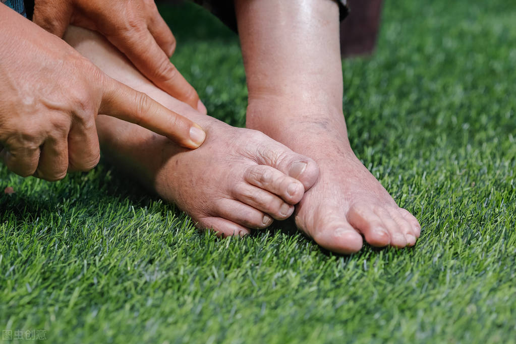 老人小腿脚浮肿是什么预兆,老年人小腿脚踝浮肿怎么回事