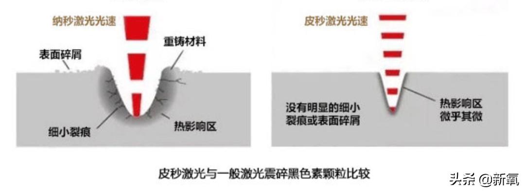 吴昕素颜真的很漂亮吗,吴昕为什么这么频繁上热搜