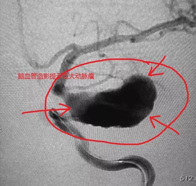 体检省钱又有效,体检去哪里做比较靠谱