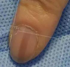 美甲怎么对指甲伤害小,长期美甲怎么保护指甲