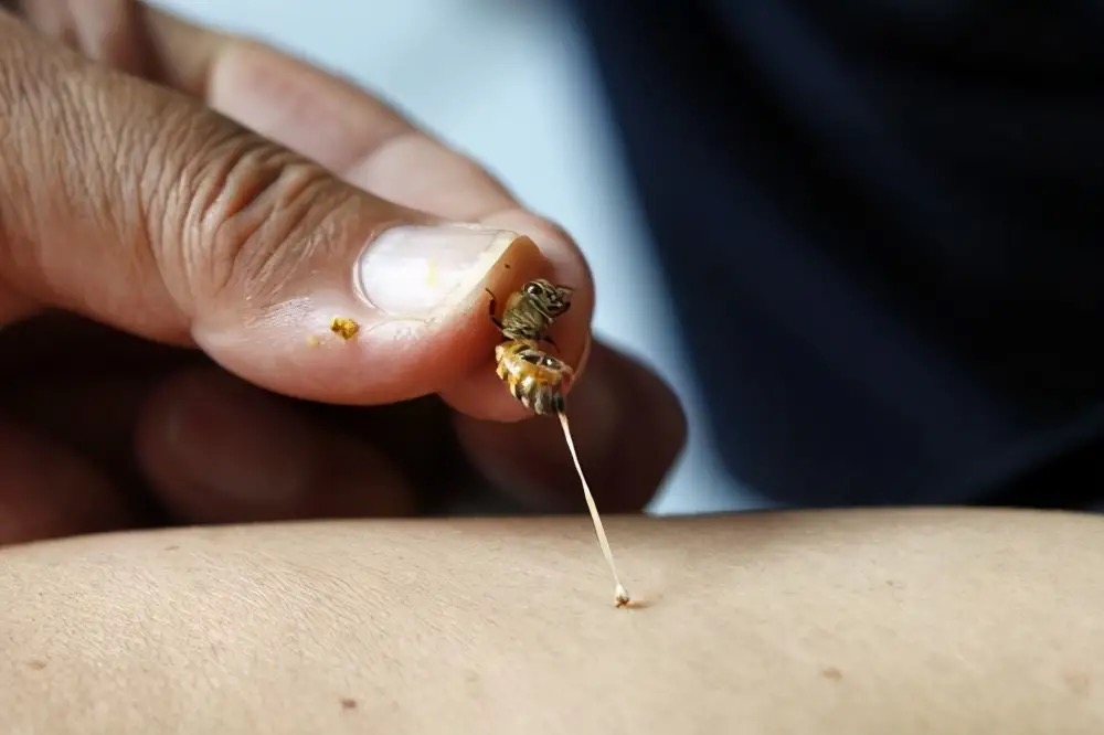 广西马蜂蜇伤事件,扫墓被马蜂蜇死