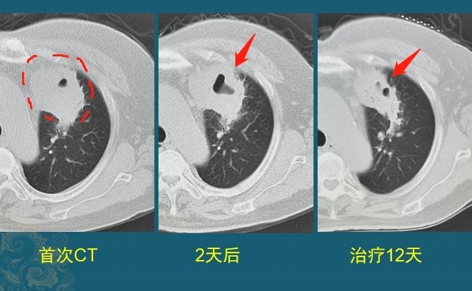 路边的野店不要去，花钱多，有些针还伤身体……