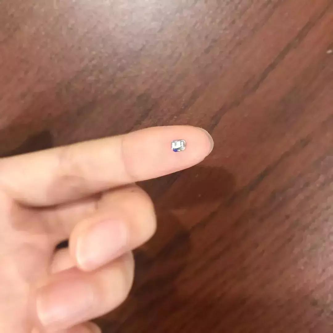 戴一个牙套会掉吗,戴个牙套对嘴唇有变化吗