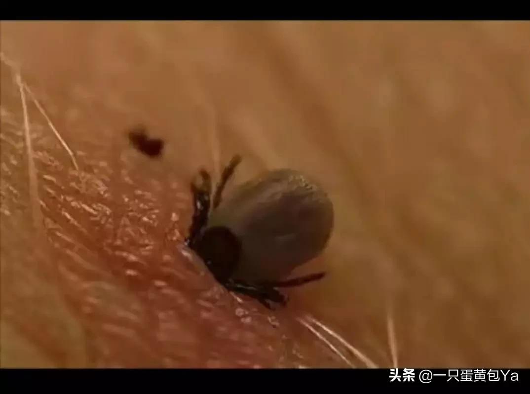 儿童头部起小疙瘩是怎么回事,小孩头上长红疙瘩像被虫咬的一样