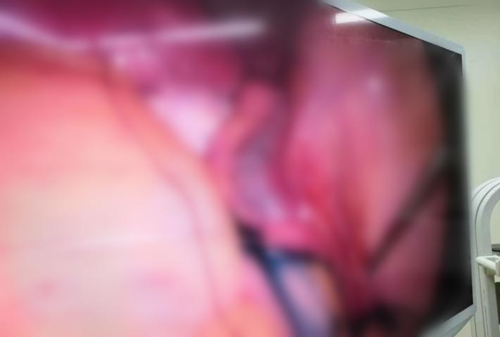 女性妇科微创手术,太原市妇科手术最好的医院