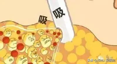 这样式儿的减肥，让身体发出求救信号