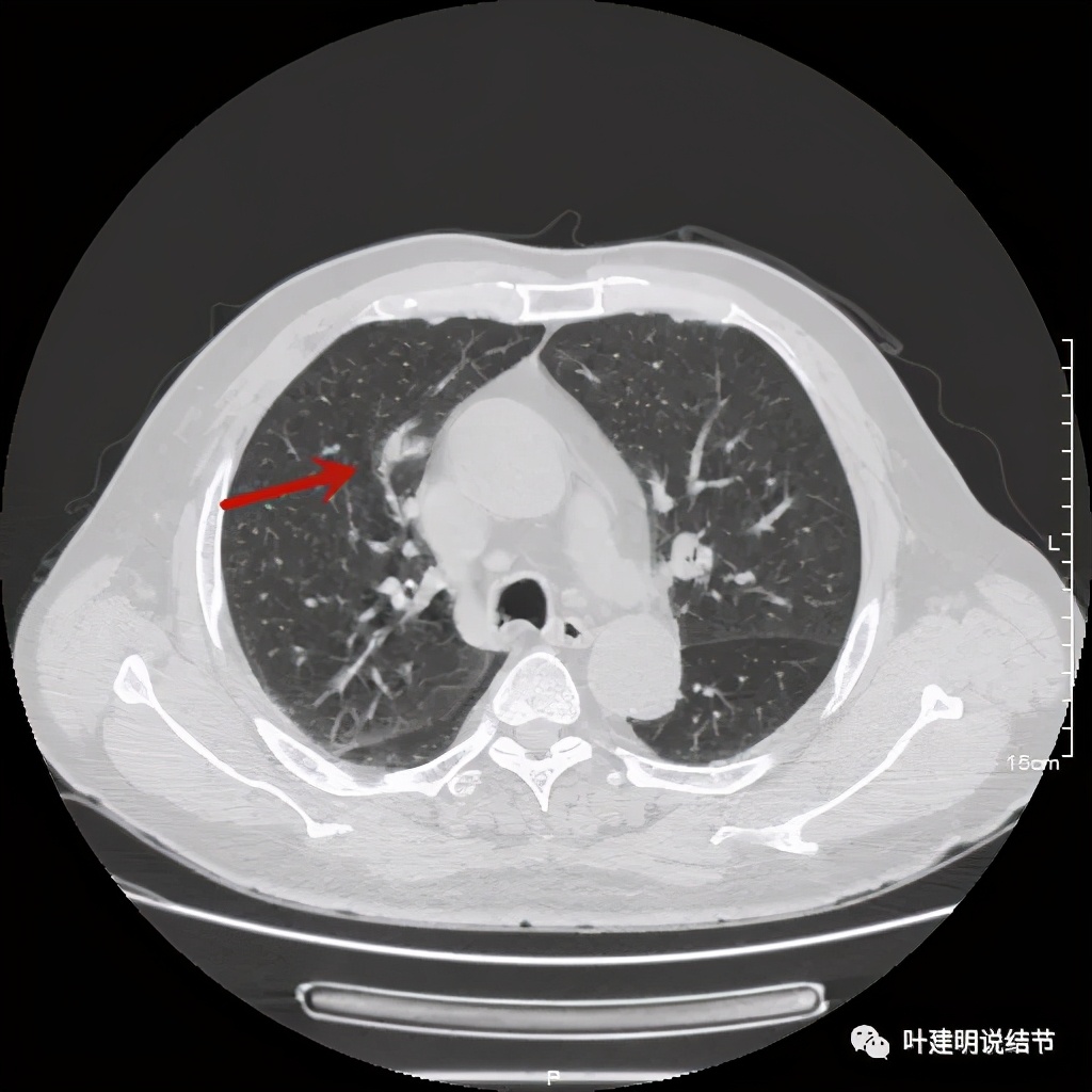 误诊报告图片,误诊案例及案例分析