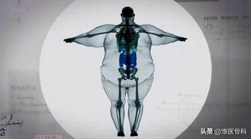 怎样练成逆天大长腿,怎样从小短腿练成大长腿