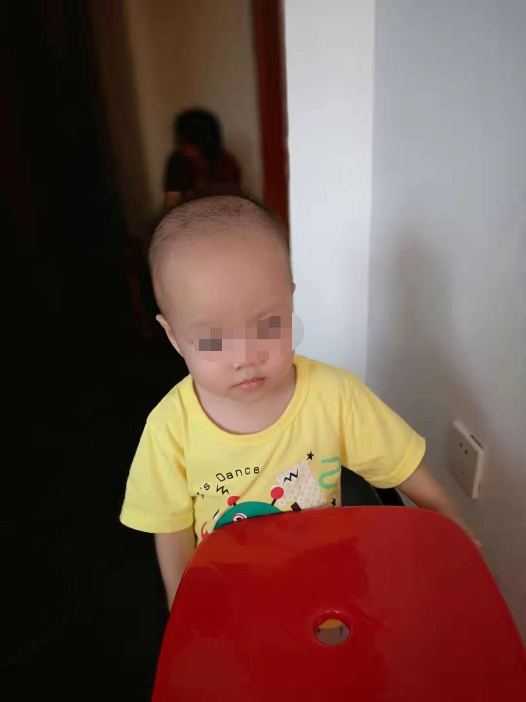 肺炎之下，我的疳积宝宝养护之路分享