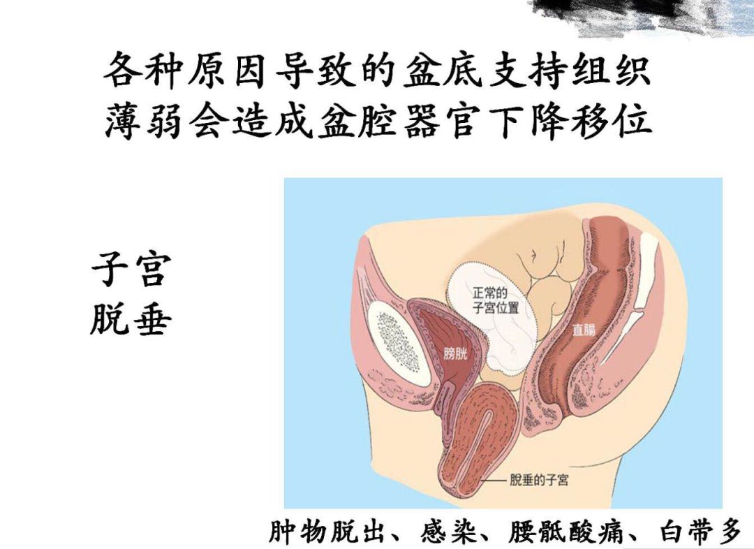 3.8产康店女神节活动方案,3.8女神节病房活动策划