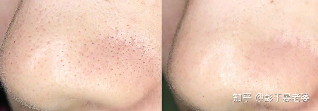 国货崛起哪个护肤品好测评,盘点国货崛起的瞬间