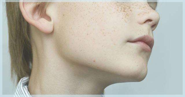 ​真是个“斑”脚石！（上集）