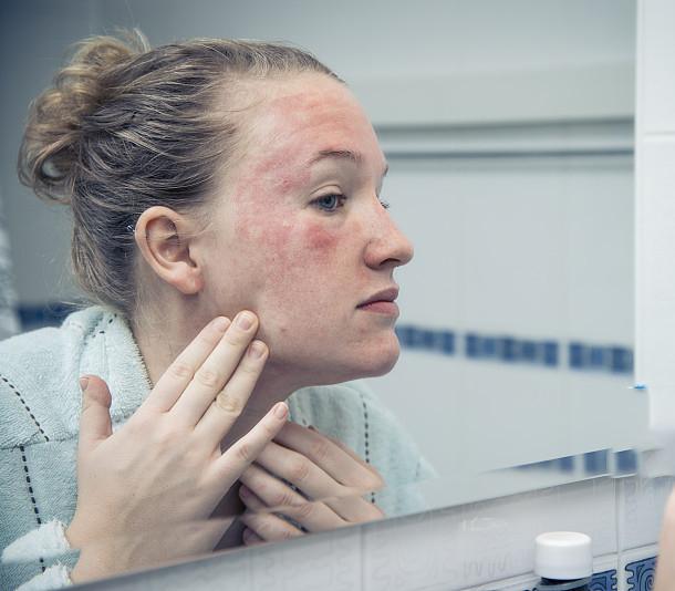 风靡全网的精华油，为什么这么火？