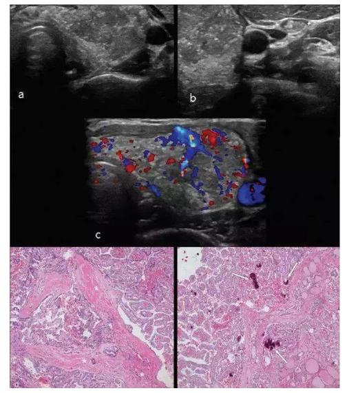 甲减不用愁，干细胞有望修复甲状腺功能