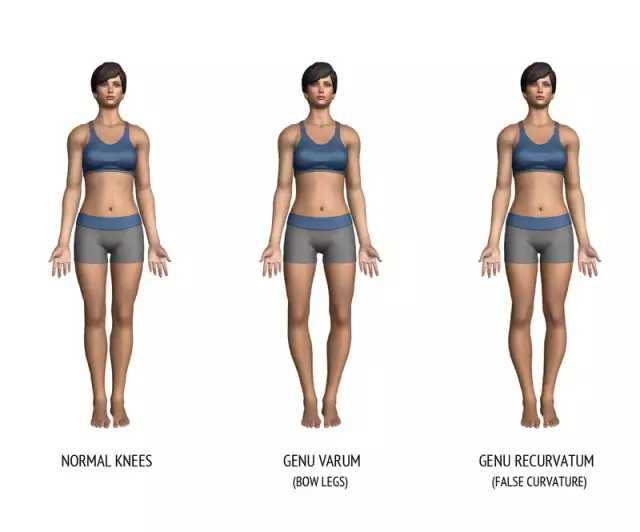 为什么腿控制不住的发抖,改善腿型有效不费劲简单方法